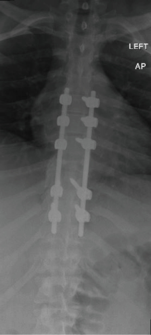 Click on image to zoom