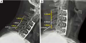 Click on image to zoom