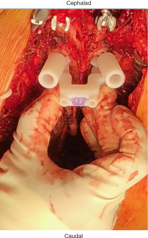 Click on image to zoom