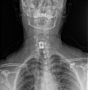 Click on image to zoom