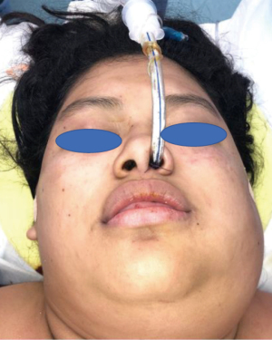 Click on image to zoom