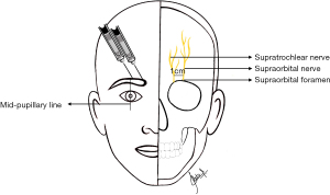 Click on image to zoom