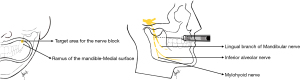 Click on image to zoom 图4