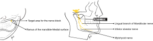 Click on image to zoom