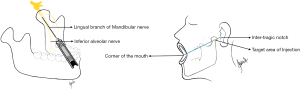 Click on image to zoom