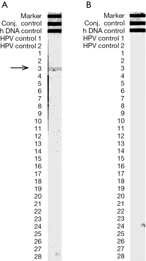 Click on image to zoom