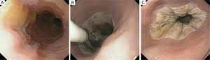 Click on image to zoom
