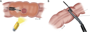 Click on image to zoom