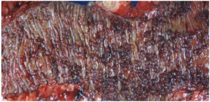Click on image to zoom