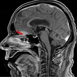 Click on image to zoom