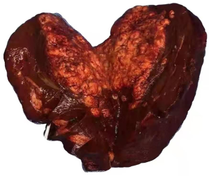 Click on image to zoom