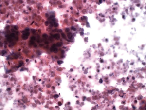 Click on image to zoom Figure 11