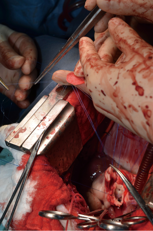 Click on image to zoom