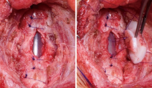 Click on image to zoom