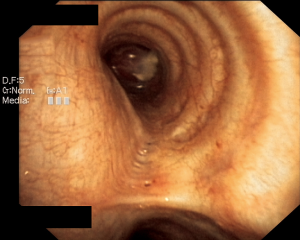 Click on image to zoom