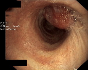 Click on image to zoom