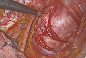 Click on image to zoom