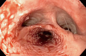 Click on image to zoom