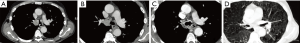 Click on image to zoom