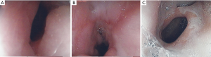 Click on image to zoom