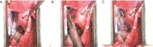 Click on image to zoom