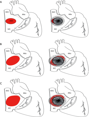 Click on image to zoom