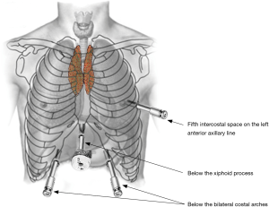 Click on image to zoom