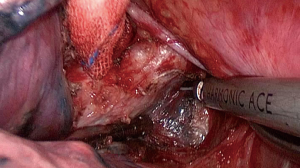 Click on image to zoom