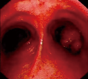 Click on image to zoom