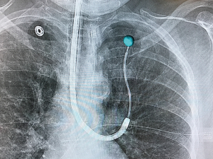 Click on image to zoom