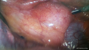 Click on image to zoom