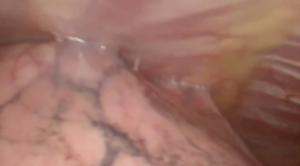Click on image to zoom