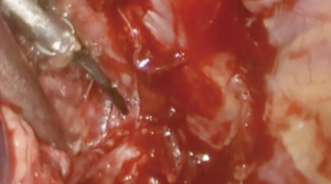 Click on image to zoom