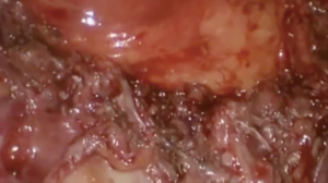 Click on image to zoom