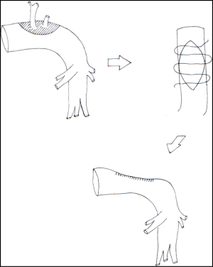 Click on image to zoom