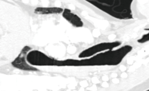 Click on image to zoom