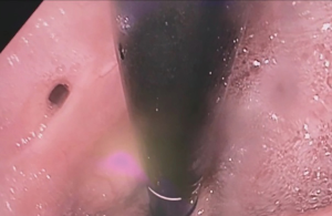 Click on image to zoom