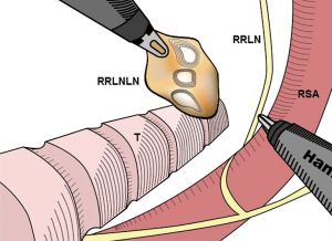 Click on image to zoom