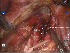 Click on image to zoom