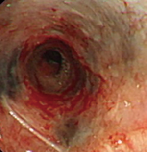 Click on image to zoom