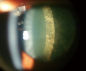 Click on image to zoom