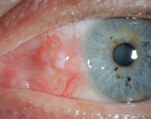 Click on image to zoom