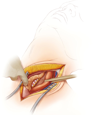 Click on image to zoom