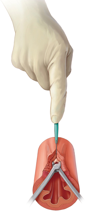 Click on image to zoom