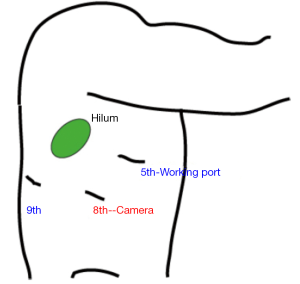 Click on image to zoom