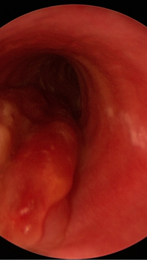 Click on image to zoom