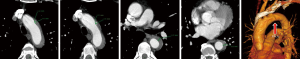 Click on image to zoom