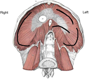 Click on image to zoom