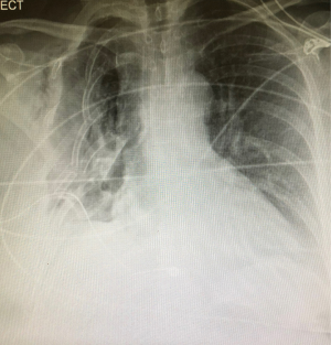 Click on image to zoom