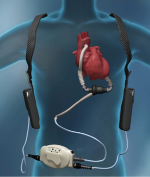 Click on image to zoom